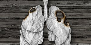 Combien de temps peut-on vivre avec un cancer du poumon ?