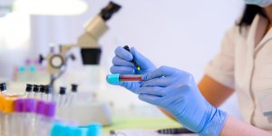 Diabete et mauvaise circulation sanguine : le lien