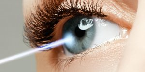 Astigmate : la correction au laser