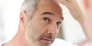 Pelade : la raison d-un blanchissement soudain des cheveux