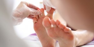 Covid-19 : urticaire, rougeurs, engelures, acrosyndromes, de nouveaux symptomes ?