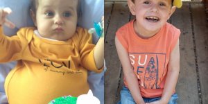 Atresie des voies biliaires : “Mon fils a ete greffe a 14 mois”