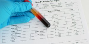 Gamma GT eleves : une maladie du foie en cause ?