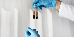 Transaminases SGOT elevees : qu-est-ce que ca cache ?