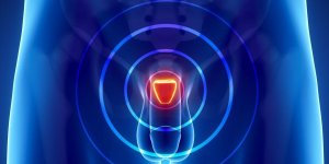 Adenome de la prostate : l-examen de debitmetrie