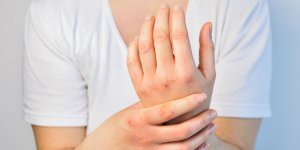 Peau seche : un lien avec l’apparition de la maladie d’Alzheimer ?