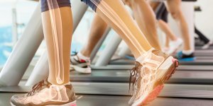 Bigorexie : quand l-addiction au sport nuit a la sante