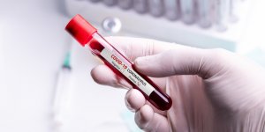 Test serologique : les conditions pour se faire rembourser