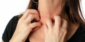Psoriasis inverse : qu-est-ce que c-est ?
