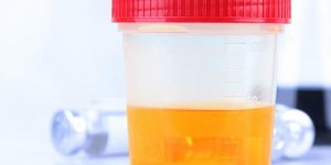 La luminosite de votre urine pourrait aider a deceler un cancer du foie