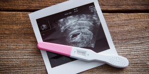 Test de grossesse faux negatif et faux positif : definitions
