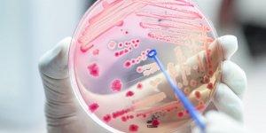 Gastro-enterite virale, bacterienne ou parasitaire : comment les reconnaitre ?