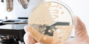 Cas contact Covid-19 : quels sont les delais d-incubation selon les variants ?