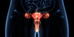 Quelle est la difference entre l’endometriose et le cancer de l’endometre ?