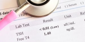Hormones : quels tests faire apres 50 ans et pourquoi ?