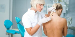 Carcinome basocellulaire : ca ressemble a quoi ?