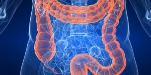 Pourquoi avoir un taux de cholesterol trop eleve augmente le risque de cancer du colon