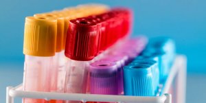 Bilan sanguin complet : comment aide-t-il au diagnostic d-un cancer ?