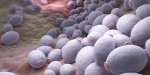 Mycose vaginale : l-infection a Candida albicans