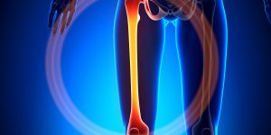 Fracture du femur : pourquoi les personnes agees sont plus a risque ?