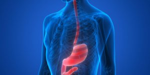 Reflux gastrique : l-alginate de sodium comme traitement
