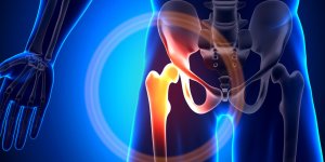 Arthrose de la hanche : lutter contre les douleurs nocturnes