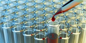 Diagnostic de diabete de type 1 : la recherche d-anticorps