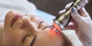 Radiofrequence : tout savoir sur ce soin liftant anti-age