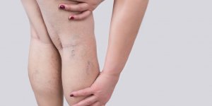Syndrome des jambes sans repos : ce medicament n-est pas recommande selon ce medecin