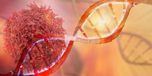 Tumeur neuroendocrine : la definition