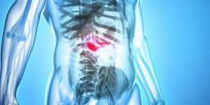Les 5 cancers les plus meurtriers 