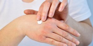 Froid : 4 astuces pour eviter les gercures