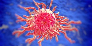 8 cancers sans symptome