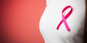 Carcinome canalaire in situ : le cancer du sein le plus frequent