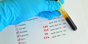 Triglycerides eleves : quel regime adopter ?