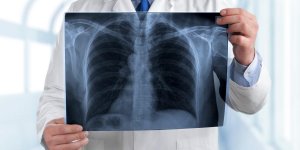 Cancer des os : les symptomes