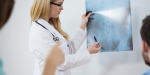 Osteoporose : le diagnostic de la demineralisation osseuse par radio