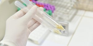 Diabete de type 2 : pourquoi surveiller son taux d-acide urique ?