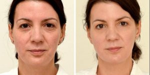 Buvez de l-eau ! Elle boit 3 litres d’eau par jour pendant 1 mois : voila le resultat