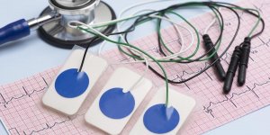 Comment voir un infarctus sur un ECG ?