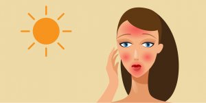 Coup de soleil au visage : 5 trucs a ne surtout pas mettre dessus 