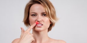 Bouton de fievre : les traitements preventifs