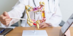 Maladie de Crohn : on pourrait la detecter 8 ans avant les symptomes