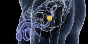 Hypertrophie de la prostate : le volume normal