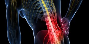 Myorelaxant : peut-on soigner une lombalgie avec ce medicament ?