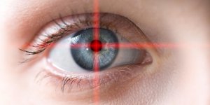 Myopie et presbytie : qu-est-ce que la chirurgie Lasik ?