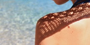 Cancer de la peau : vos grains de beaute doivent-ils vous inquieter ? 