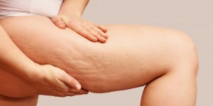 Cuisses : les 3 astuces pour les muscler