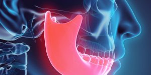 Comment reconnaitre un cancer de la machoire ?