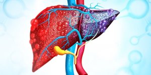 Cirrhose du foie : les 7 symptomes d-alerte
